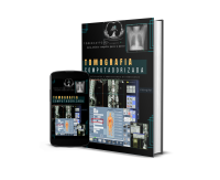 Livro de Tomografia Computadorizada